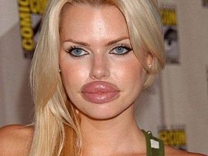 lips plastic surgery