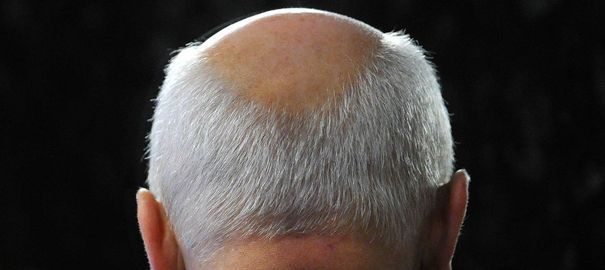 Politique chauve