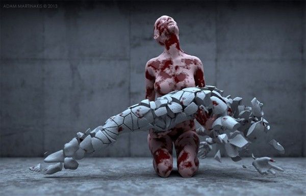 fracture