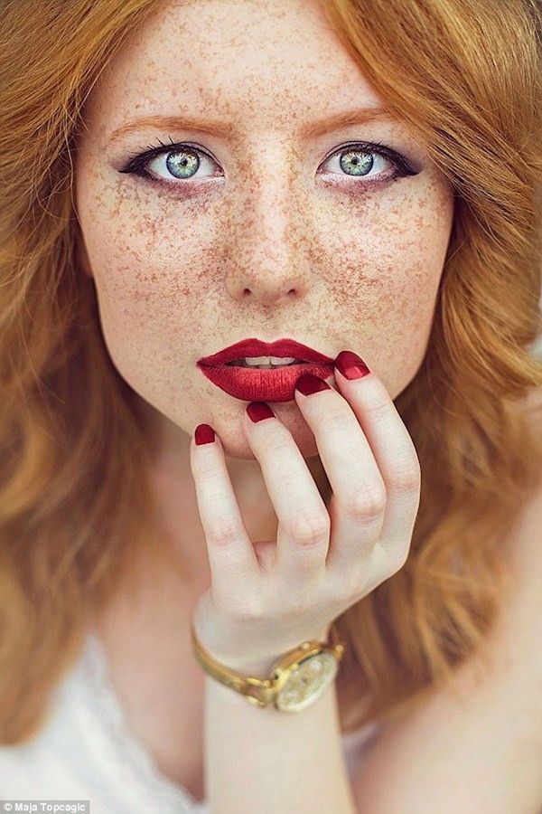 Et si les tâches de rousseurs étaient sexy ?
