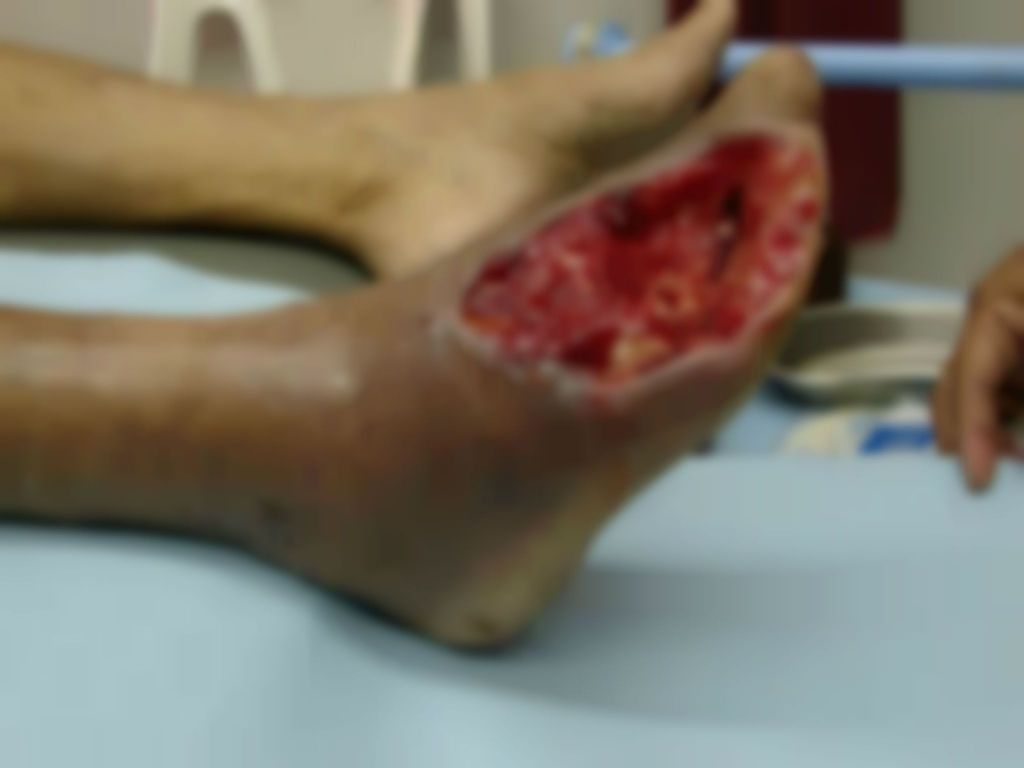 Krokodil